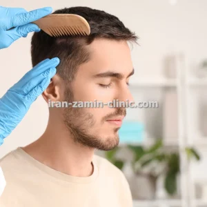 پکیج ویژه کاشت مو به روش طبیعی همراه با معاینه رایگان