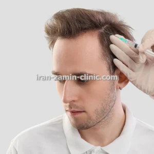 کاشت مو به روش طبیعی با قیمت استثنایی و ویزیت رایگان